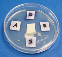 Bacteria growth in a petri dish