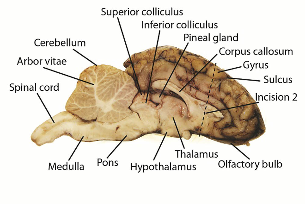 complex sheep brain