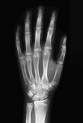 Hand X-Ray