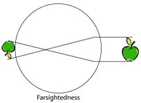 how vision works for farsighted