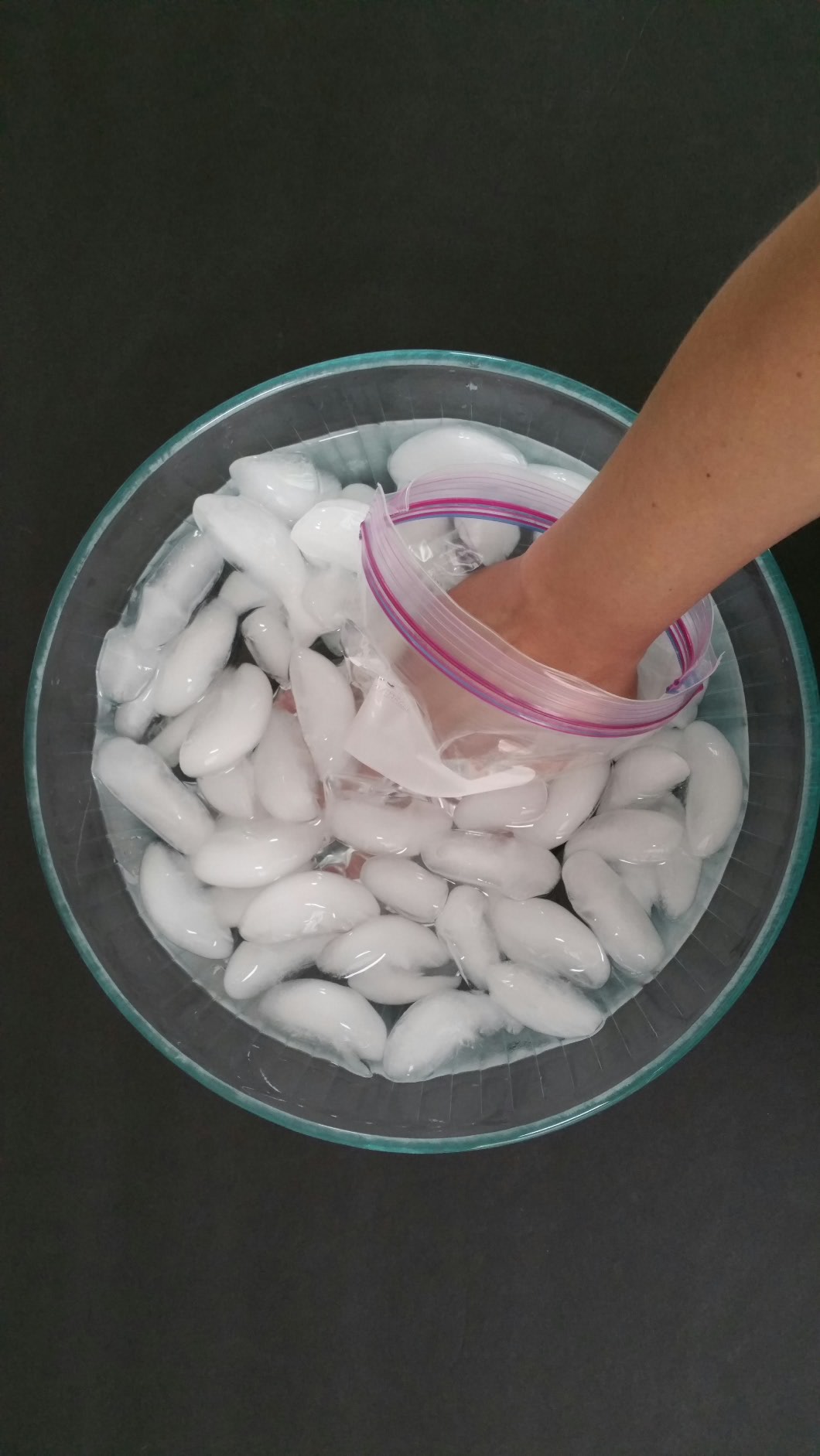 Whale Blubber Experiment Hst Life Science Project